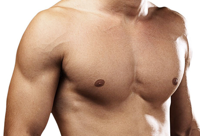Abdominoplastia - Dr. Roger Vieira